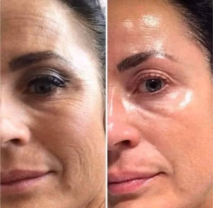 Gluta White Niacinamide + Zinc Serum