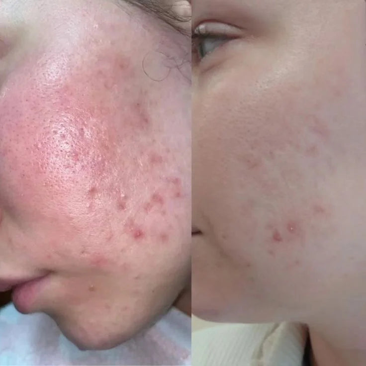 Gluta White Niacinamide + Zinc Serum